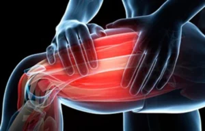 DOMS - delayed onset muscle soreness